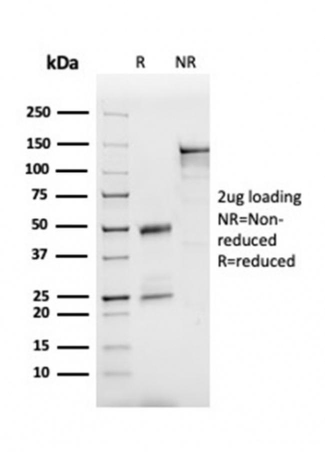 Apolipoprotein B /APOB Antibody in SDS-PAGE (SDS-PAGE)