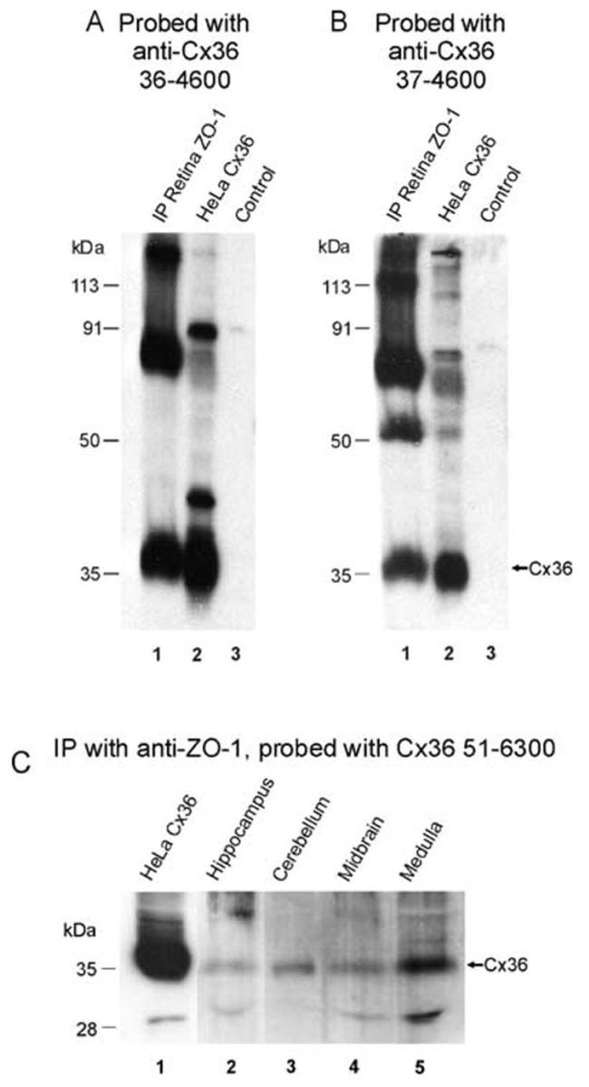 Connexin 36 Antibody in Immunoprecipitation (IP)