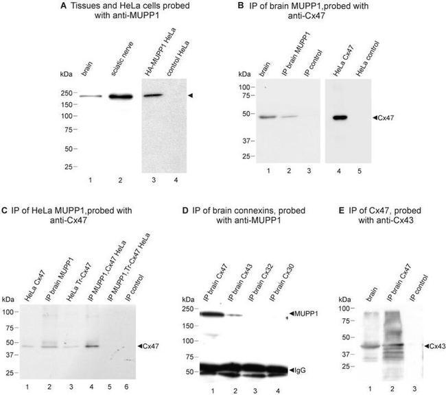 Connexin 32 Antibody in Immunoprecipitation (IP)