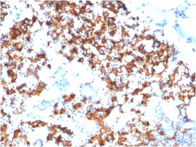 IL3RA/CD123 Antibody in Immunohistochemistry (Paraffin) (IHC (P))