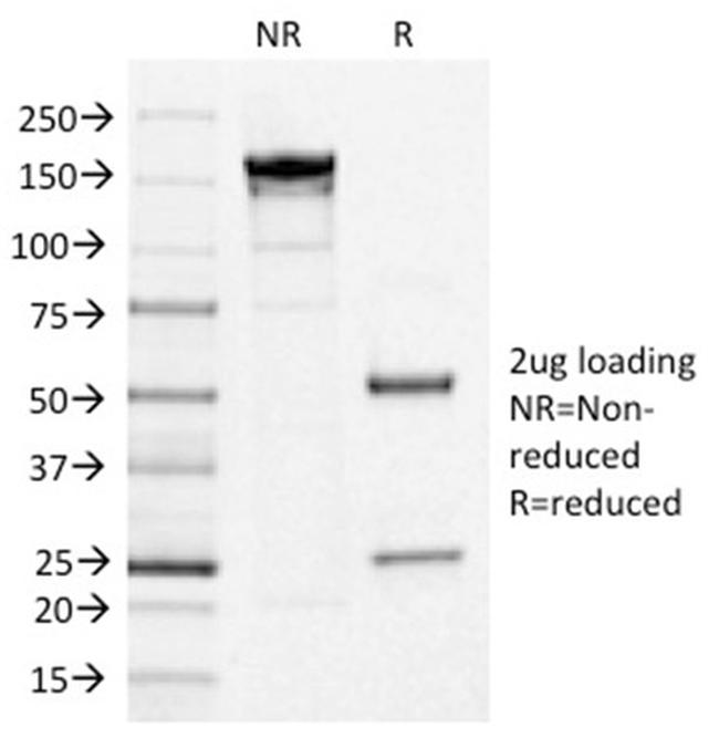IL3RA/CD123 Antibody in SDS-PAGE (SDS-PAGE)
