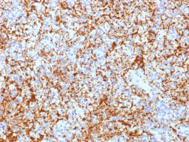CD61/Integrin 3/Platelet Glycoprotein IIIa Antibody in Immunohistochemistry (Paraffin) (IHC (P))