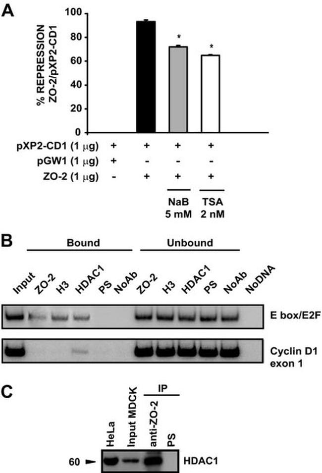 ZO-2 Antibody in Immunoprecipitation (IP)