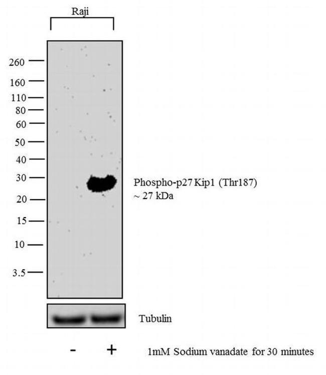 Phospho-p27 Kip1 (Thr187) Antibody in Western Blot (WB)