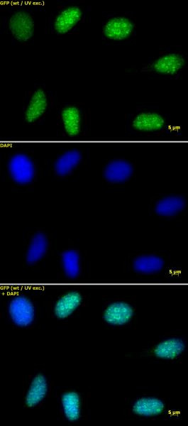 Histone H3K9me3 Antibody in Immunocytochemistry (ICC/IF)