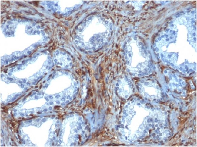 Galectin-1/Human Placental Lactogen (hPL) Antibody in Immunohistochemistry (Paraffin) (IHC (P))