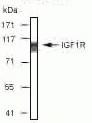 IGF1R beta Antibody in Western Blot (WB)