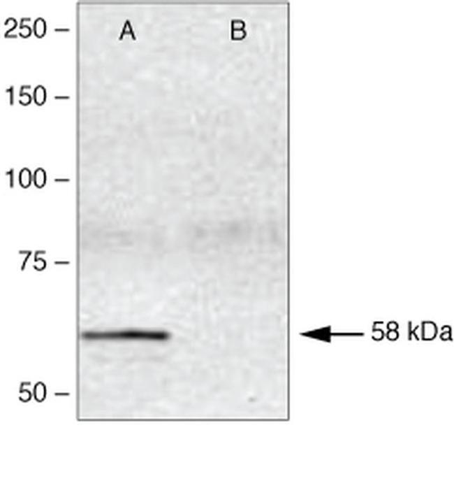 Phospho-SMAD2 (Ser465, Ser467) Antibody