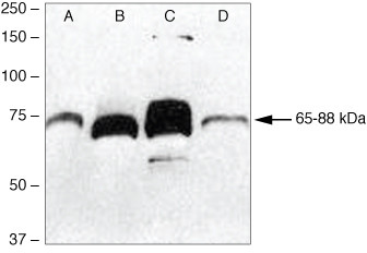 PCDGF Antibody in Western Blot (WB)