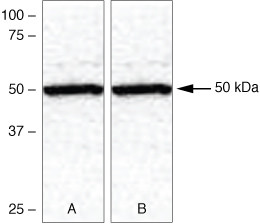 TXNIP Antibody in Western Blot (WB)