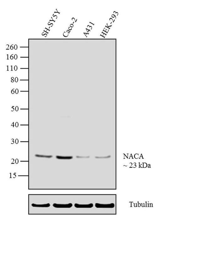 NACA Antibody in Western Blot (WB)