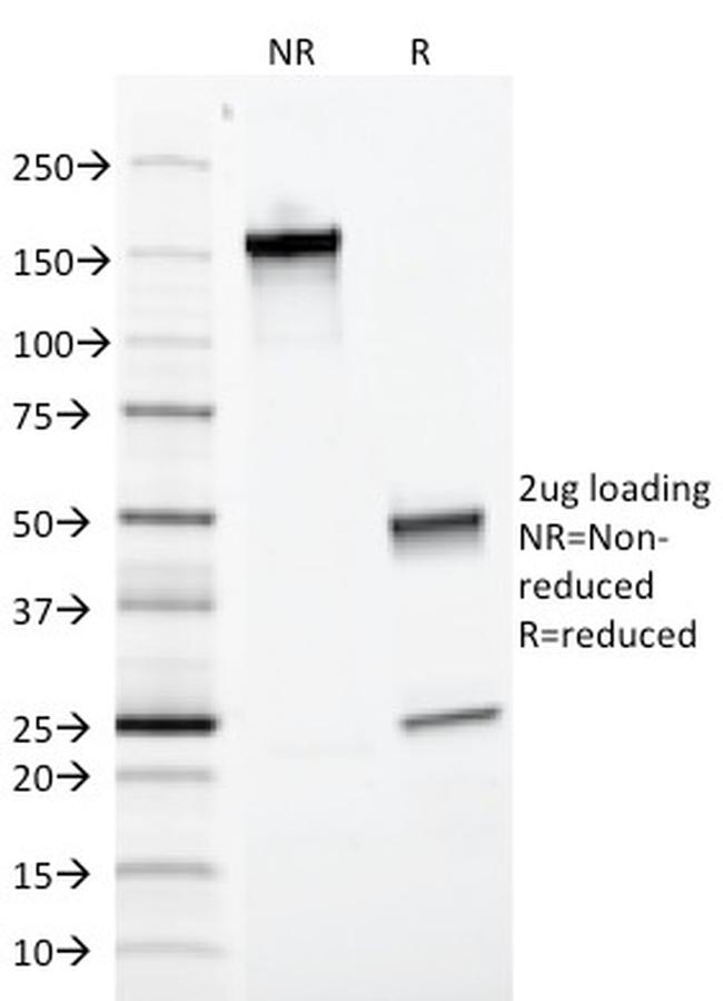 Ep-CAM/CD326 Antibody in SDS-PAGE (SDS-PAGE)