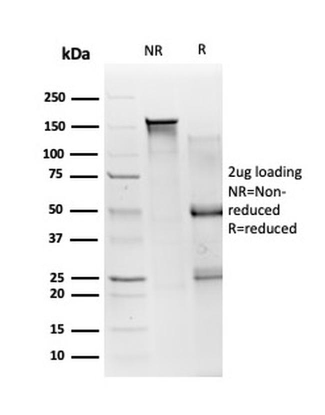 SMAD3 Antibody in SDS-PAGE (SDS-PAGE)