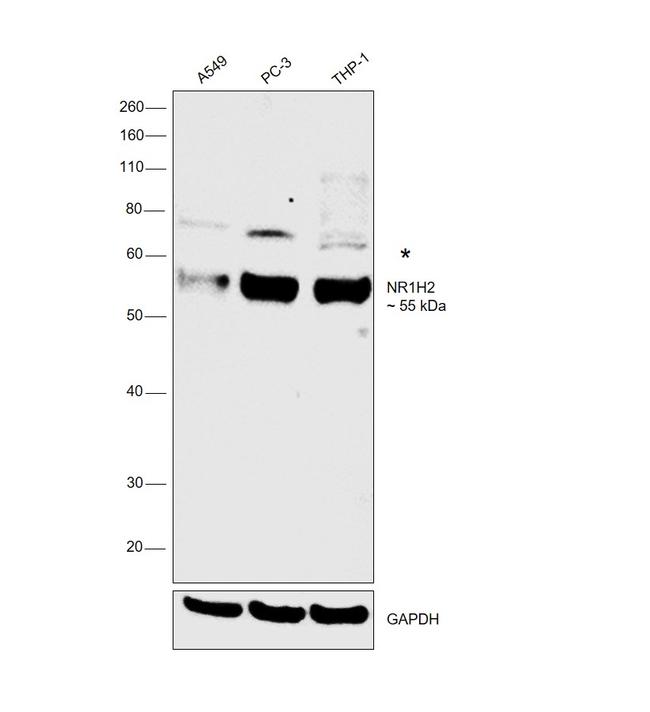 LXR beta Antibody in Western Blot (WB)