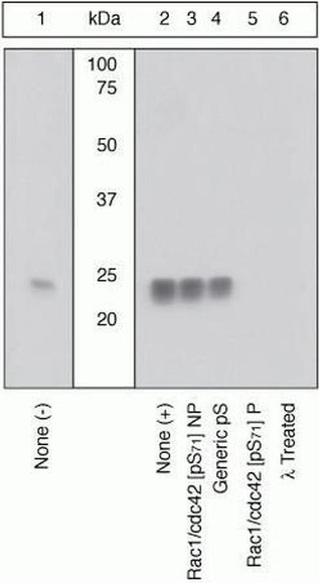 Phospho-RAC1/CDC42 (Ser71) Antibody