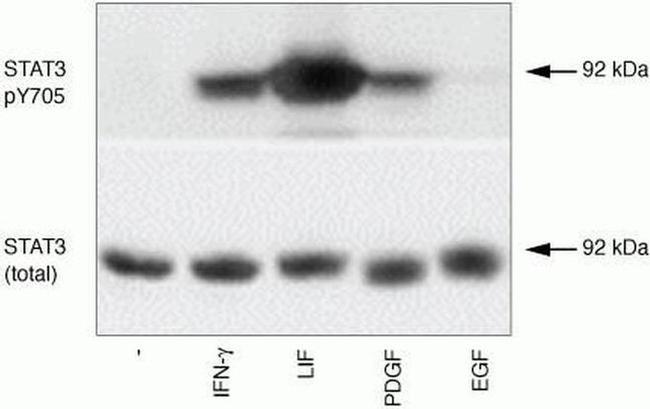 Phospho-STAT3 (Tyr705) Antibody