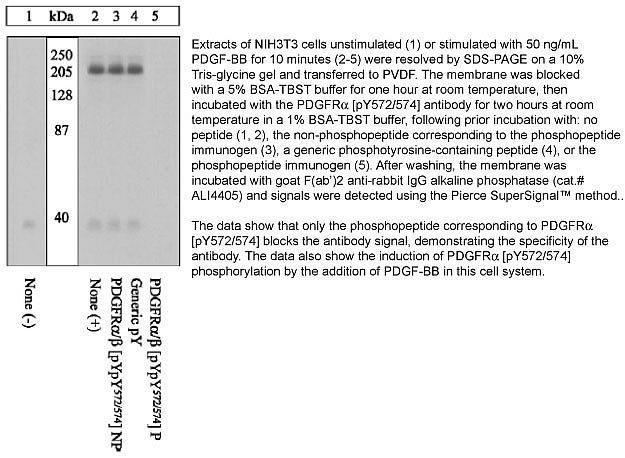 Phospho-PDGFRA/PDGFRB (Tyr572, Tyr574) Antibody in Western Blot (WB)