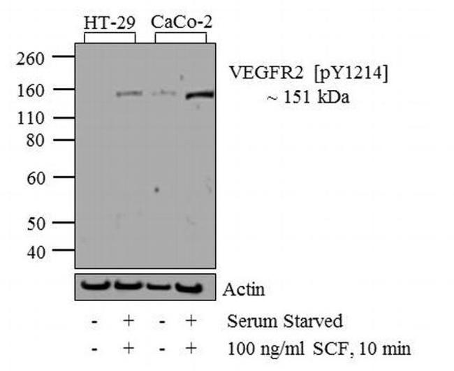 Phospho-VEGF Receptor 2 (Tyr1214) Antibody