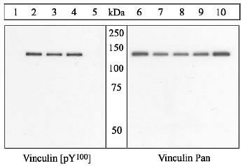 Phospho-Vinculin (Tyr100) Antibody in Western Blot (WB)