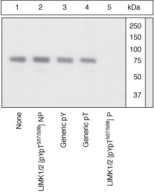 Phospho-LIMK1 (Tyr507, Thr508) Antibody in Western Blot (WB)