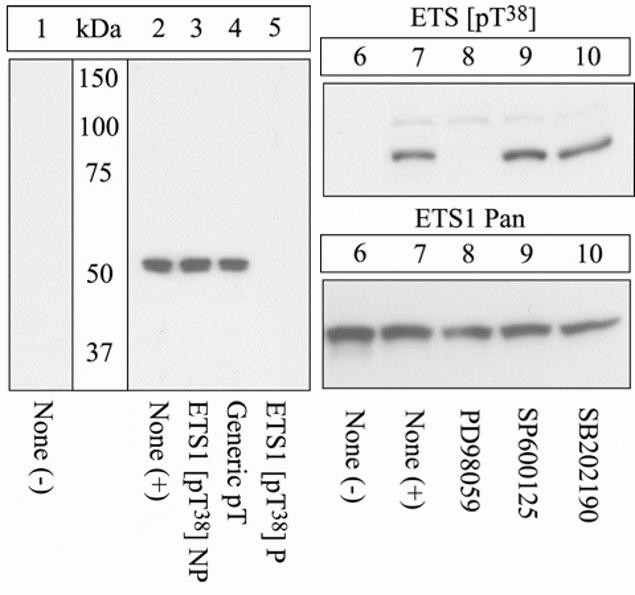 Phospho-ETS1 (Thr38) Antibody in Western Blot (WB)