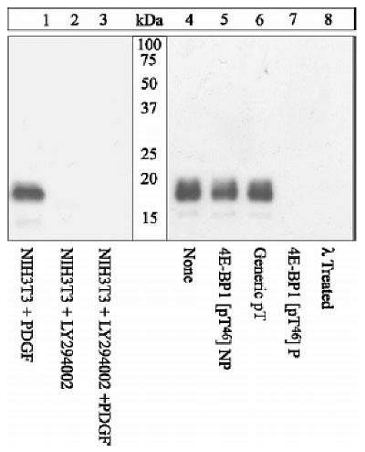 Phospho-4EBP1 (Thr46) Antibody in Western Blot (WB)