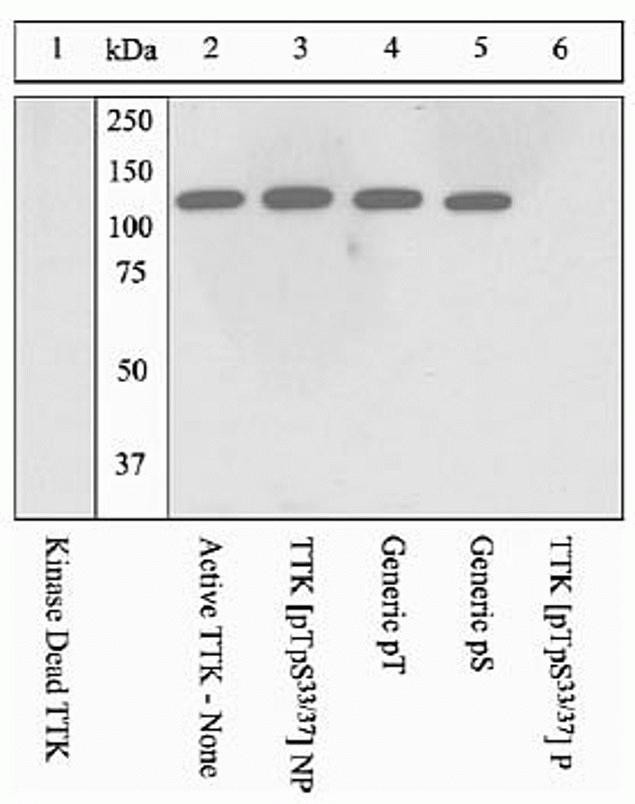 Phospho-TTK (Thr33, Ser37) Antibody in Western Blot (WB)