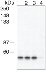 Phospho-beta Arrestin 1 (Ser412) Antibody in Western Blot (WB)