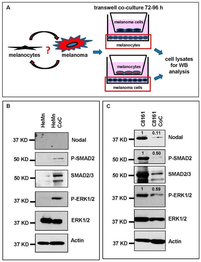 Phospho-SMAD2 (Ser465, Ser467) Antibody in Western Blot (WB)