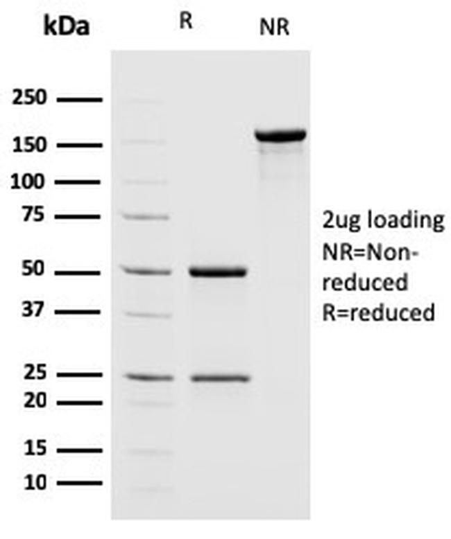 MSH2 Antibody in SDS-PAGE (SDS-PAGE)