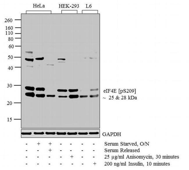 Phospho-eIF4E (Ser209) Antibody in Western Blot (WB)