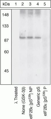 Phospho-eIF2b epsilon (Ser539) Antibody in Western Blot (WB)