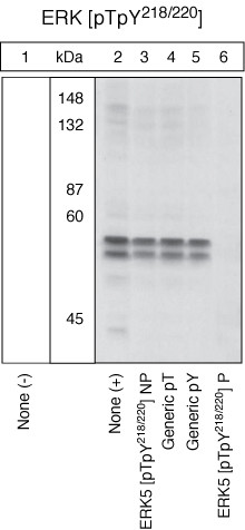 Phospho-ERK5 (Thr218, Tyr220) Antibody in Western Blot (WB)