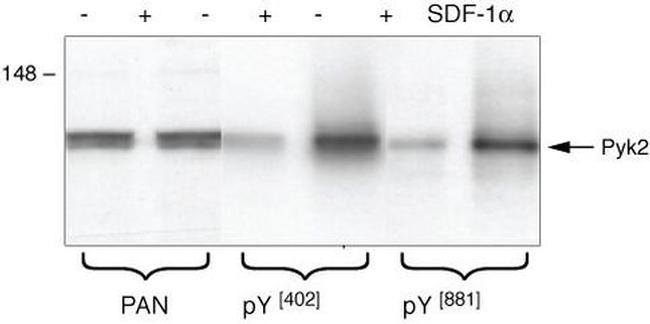 Phospho-PYK2 (Tyr402) Antibody