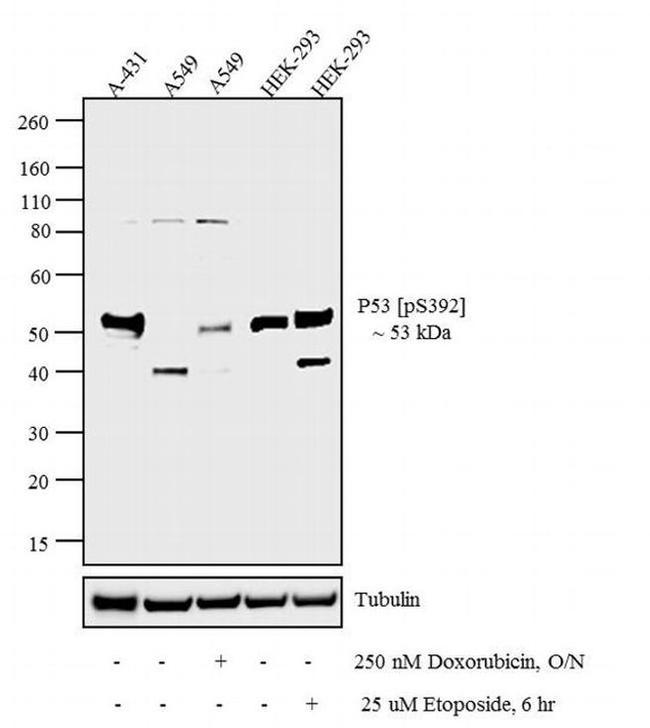 Phospho-p53 (Ser392) Antibody in Western Blot (WB)