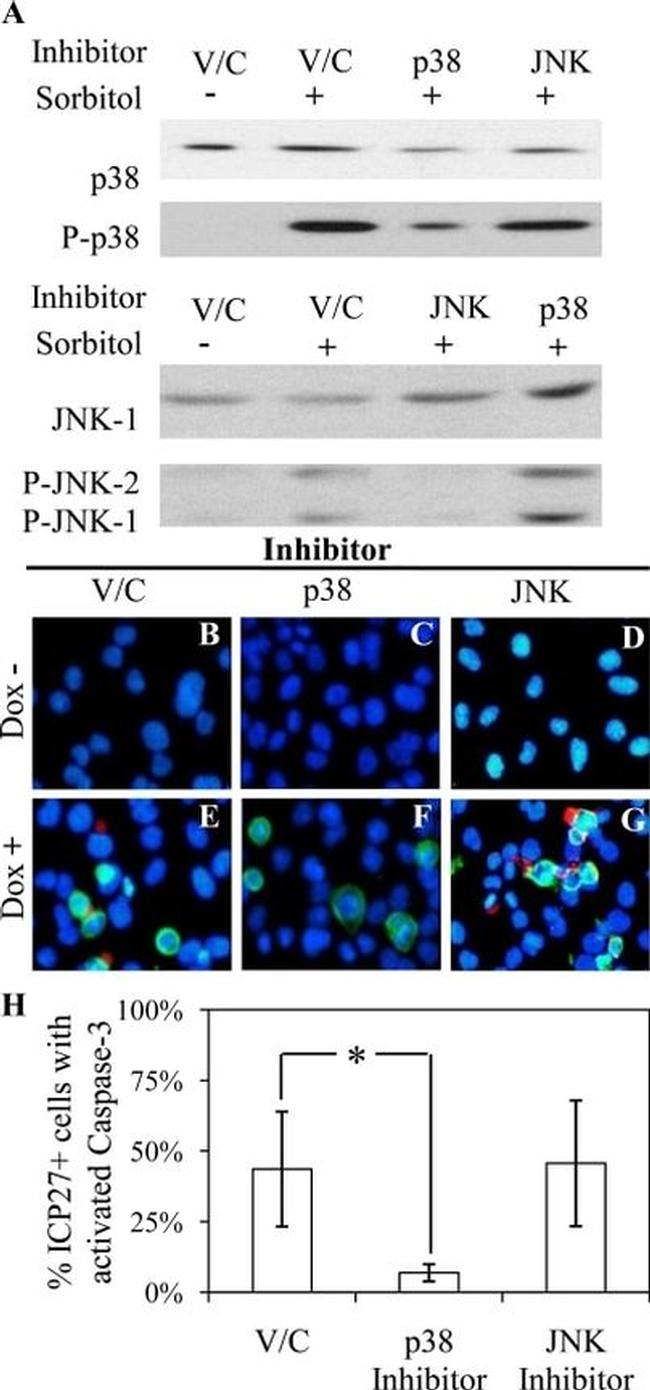 Phospho-JNK1/JNK2 (Thr183, Tyr185) Antibody in Western Blot (WB)