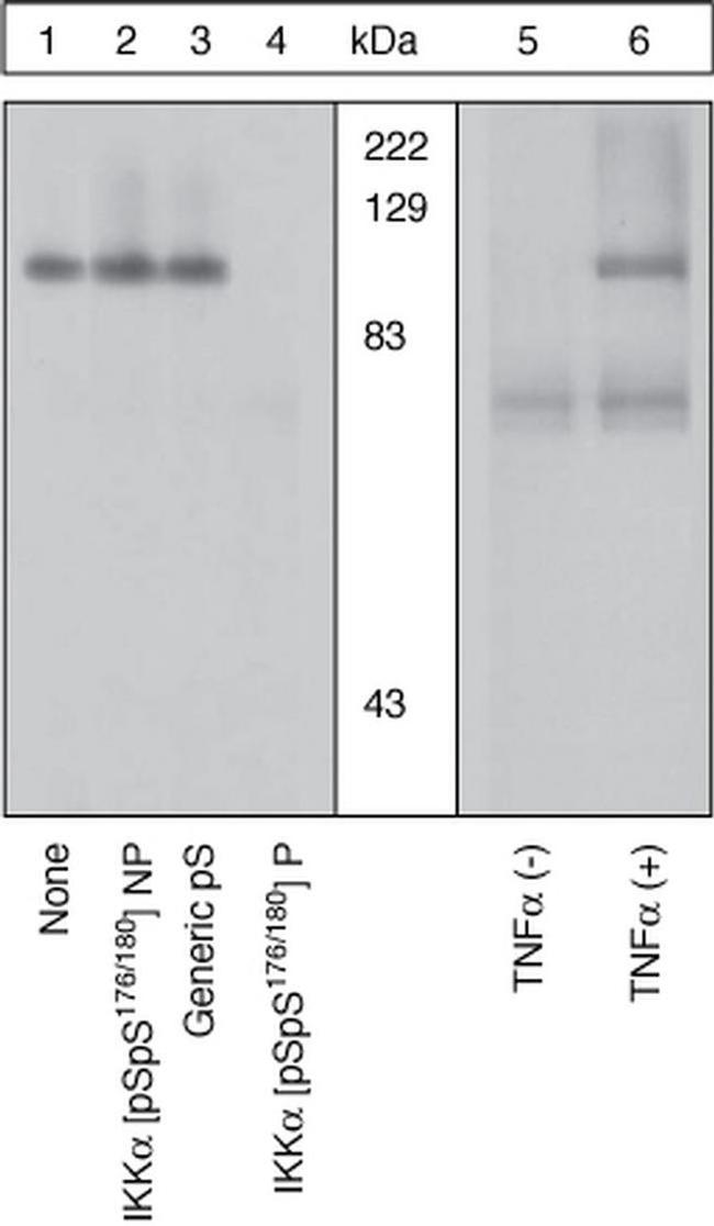Phospho-IKK alpha (Ser176, Ser180) Antibody