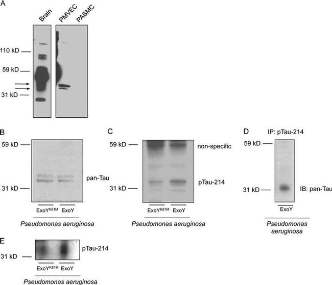 Phospho-Tau (Ser214) Antibody in Western Blot, Immunoprecipitation (WB, IP)