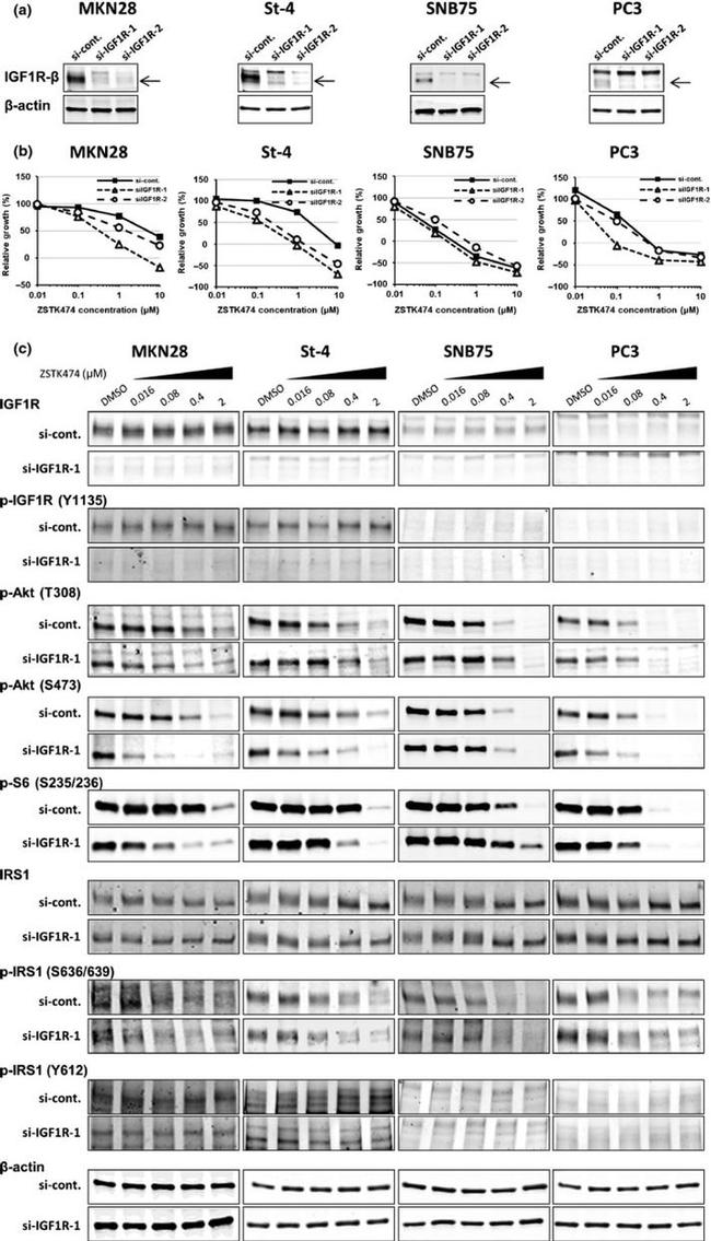 Phospho-IRS1 (Tyr612) Antibody in Western Blot (WB)