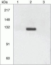Phospho-CD61 (Tyr773) Antibody in Western Blot (WB)