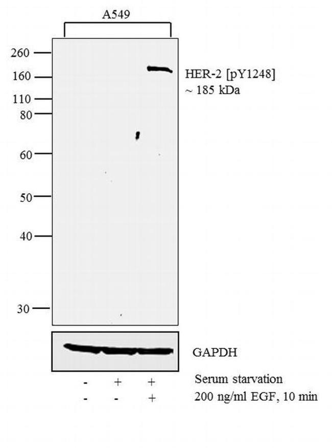 Phospho-ErbB2 (HER-2) (Tyr1248) Antibody