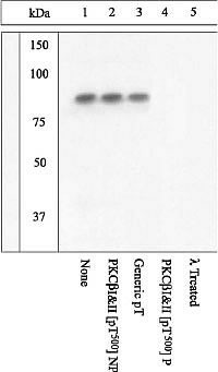 Phospho-PKC beta-1,2 (Thr500) Antibody in Western Blot (WB)