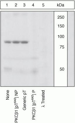 Phospho-PKC beta-1 (Thr642) Antibody in Western Blot (WB)