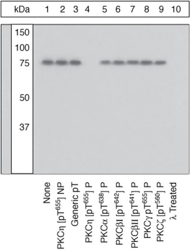 Phospho-PKC eta (Thr655) Antibody