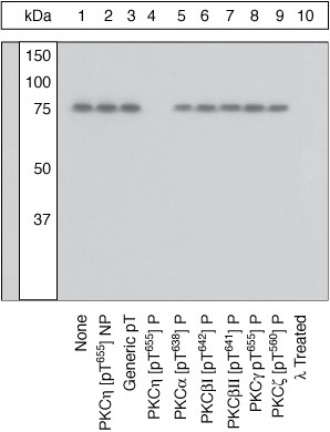 Phospho-PKC eta (Thr655) Antibody in Western Blot (WB)