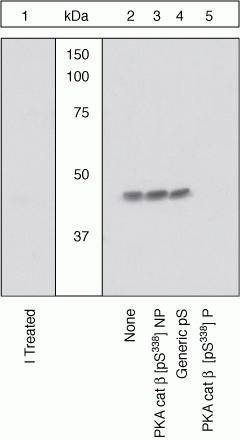 Phospho-PKA beta (Ser338) Antibody in Western Blot (WB)