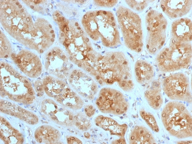 MTAP (Tumor Suppressor Marker) Antibody in Immunohistochemistry (Paraffin) (IHC (P))