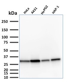 MTAP (Tumor Suppressor Marker) Antibody in Western Blot (WB)