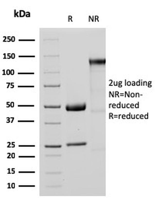 MTAP Antibody in SDS-PAGE (SDS-PAGE)