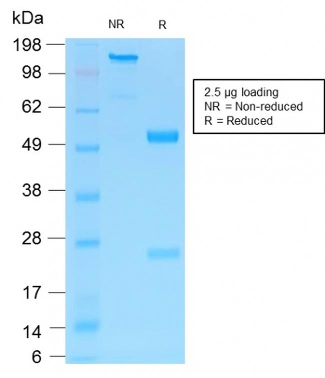 NGF-Receptor (p75)/CD271 Antibody in SDS-PAGE (SDS-PAGE)